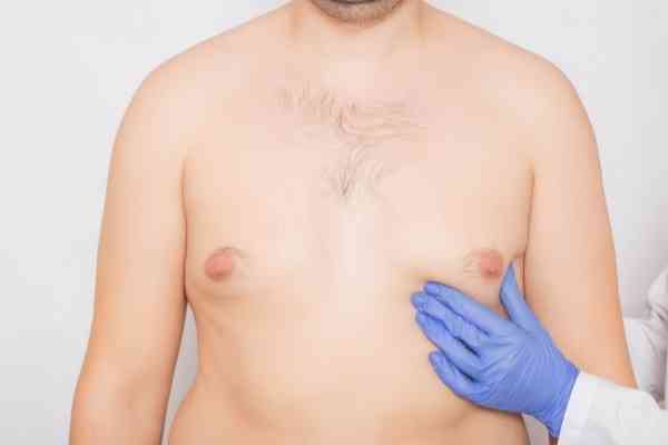 Male Breast Augmentation Surgery